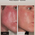 Mascarilla facial antiarrugas con terapia de luz (incluye mascarilla para el cuello GRATIS)