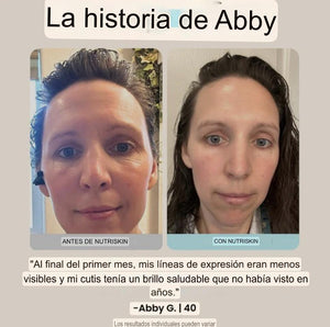 Mascarilla facial antiarrugas con terapia de luz (incluye mascarilla para el cuello GRATIS)